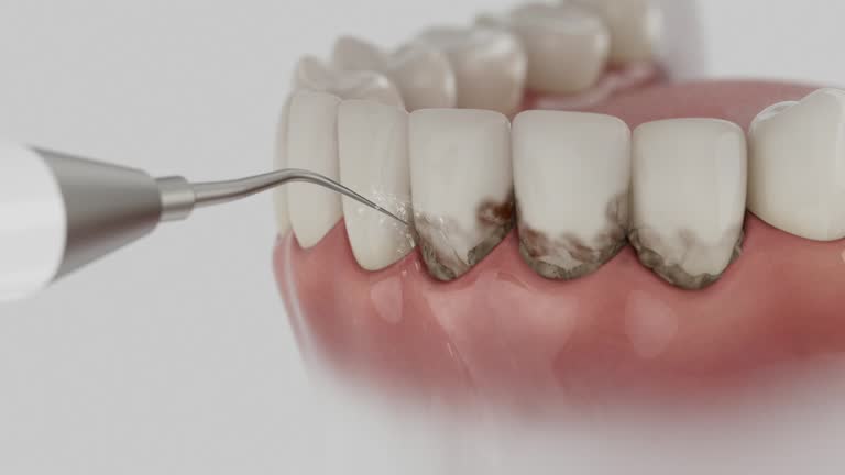 Trusted Teeth Cleaning And Checkup service in Kingston, WA - Dentist Open Now